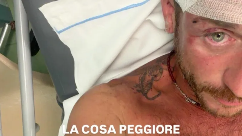 Italian Beach Attack: Man Beaten for Being Gay, Solidarity Grows