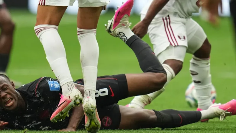 Horror Injury Mars Canada's World Cup Victory Over Qatar