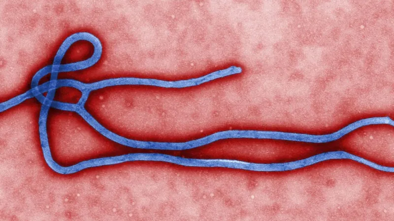 Bundibugyo Ebola: Stanford Expert Urges Global Unity Against Rare Strain