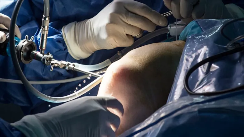 Revolutionary Fast-Track Surgery Accelerates Joint Operation Recovery