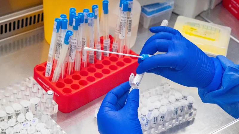 US Intelligence Warns: Ukraine Biolabs Face Severe Risk Amid Conflict